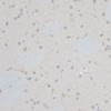 Immunohistochemistry of paraffin-embedded Rat brain using ZNF415 Polyclonal Antibody at dilution of  1:100 (40x lens).