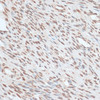 Immunohistochemistry of paraffin-embedded Human uterus using ZNF574 Polyclonal Antibody at dilution of  1:100 (40x lens).