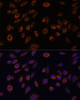 Immunofluorescence analysis of L929 cells using NTPCR Polyclonal Antibody at dilution of  1:100. Blue: DAPI for nuclear staining.