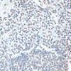 Immunohistochemistry of paraffin-embedded Human appendix using ZNF433 Polyclonal Antibody at dilution of  1:100 (40x lens).