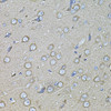 Immunohistochemistry of paraffin-embedded Rat brain using Osteopontin Polyclonal Antibody at dilution of  1:100 (40x lens).