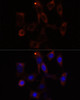 Immunofluorescence analysis of NIH/3T3 cells using YTHDC2 Polyclonal Antibody at dilution of  1:100. Blue: DAPI for nuclear staining.