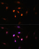 Immunofluorescence analysis of U2OS cells using KAT6A Polyclonal Antibody at dilution of  1:100. Blue: DAPI for nuclear staining.
