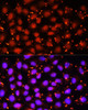 Immunofluorescence analysis of HeLa cells using ACAA1 Polyclonal Antibody at dilution of  1:100 (40x lens). Blue: DAPI for nuclear staining.
