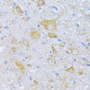 Immunohistochemistry of paraffin-embedded Mouse spinal cord using ACADSB Polyclonal Antibody at dilution of  1:100 (40x lens).