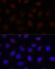 Immunofluorescence analysis of HeLa cells using ACADSB Polyclonal Antibody at dilution of  1:100 (40x lens). Blue: DAPI for nuclear staining.