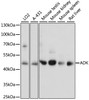 Western blot analysis of extracts of various cell lines using ADK Polyclonal Antibody at dilution of 1:1000.