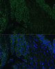 Immunofluorescence analysis of Human colon carcinoma using CLCA1 Polyclonal Antibody at dilution of  1:100 (40x lens). Blue: DAPI for nuclear staining.