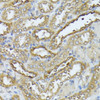 Immunohistochemistry of paraffin-embedded Rat kidney using DAPK3 Polyclonal Antibody at dilution of  1:100 (40x lens).