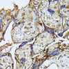 Immunohistochemistry of paraffin-embedded Human placenta using DAPK3 Polyclonal Antibody at dilution of  1:100 (40x lens).