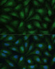 Immunofluorescence analysis of U-2 OS cells using DAPK3 Polyclonal Antibody at dilution of  1:100 (40x lens). Blue: DAPI for nuclear staining.