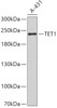 Western blot analysis of extracts of A-431 cells using TET1 Polyclonal Antibody.