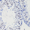 Immunohistochemistry of paraffin-embedded Mouse testis using TET1 Polyclonal Antibody at dilution of  1:100 (40x lens).