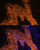 Immunofluorescence analysis of Human skin using KRT14 Polyclonal Antibody at dilution of  1:100. Blue: DAPI for nuclear staining.