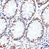 Immunohistochemistry of paraffin-embedded Human colon using HSPA1A Monoclonal Antibody at dilution of  1:100 (40x lens).