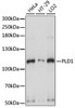 Western blot analysis of extracts of various cell lines using PLD1 Polyclonal Antibody at dilution of 1:1000.