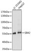 Western blot analysis of extracts of various cell lines using SIM2 Polyclonal Antibody at dilution of 1:1000.