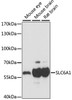 Western blot analysis of extracts of various cell lines using SLC6A1 Polyclonal Antibody at dilution of 1:1000.