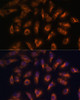 Immunofluorescence analysis of U-2 OS cells using SSTR2 Polyclonal Antibody at dilution of  1:100 (40x lens). Blue: DAPI for nuclear staining.