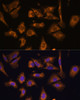 Immunofluorescence analysis of U-2 OS cells using EIF5B Polyclonal Antibody at dilution of  1:100. Blue: DAPI for nuclear staining.