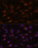 Immunofluorescence analysis of C6 cells using RNASEH2A Polyclonal Antibody at dilution of  1:100. Blue: DAPI for nuclear staining.