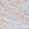 Immunohistochemistry of paraffin-embedded Mouse kidney using CLDN17 Polyclonal Antibody at dilution of  1:100 (40x lens).