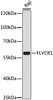 Western blot analysis of extracts of Raji cells using FLVCR1 Polyclonal Antibody at dilution of 1:1000.