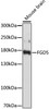 Western blot analysis of extracts of Mouse brain using FGD5 Polyclonal Antibody at dilution of 1:1000.