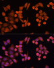 Immunofluorescence analysis of Hela cells using PLA2G4D Polyclonal Antibody at dilution of  1:100 (40x lens). Blue: DAPI for nuclear staining.