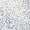 Immunohistochemistry of paraffin-embedded Human tonsil using Acetyl-Histone H4-K5 Polyclonal Antibody at dilution of  1:100 (40x lens).