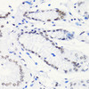 Immunohistochemistry of paraffin-embedded Human stomach using Acetyl-Histone H4-K5 Polyclonal Antibody at dilution of  1:100 (40x lens).