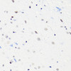 Immunohistochemistry of paraffin-embedded Mouse brain using Acetyl-Histone H4-K5 Polyclonal Antibody at dilution of  1:100 (40x lens).