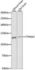 Western blot analysis of extracts of various cell lines using CTNNA2 Polyclonal Antibody at dilution of 1:1000.