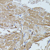 Immunohistochemistry of paraffin-embedded Mouse heart using FLII Polyclonal Antibody at dilution of  1:100 (40x lens).