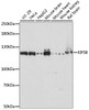 Western blot analysis of extracts of various cell lines using KIF5B Polyclonal Antibody at dilution of 1:1000.