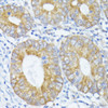 Immunohistochemistry of paraffin-embedded Human colon using PFDN4 Polyclonal Antibody at dilution of  1:100 (40x lens).