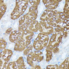 Immunohistochemistry of paraffin-embedded Mouse kidney using PLS1 Polyclonal Antibody at dilution of  1:100 (40x lens).