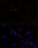 Immunofluorescence analysis of L929 cells using RNF112 Polyclonal Antibody at dilution of  1:100. Blue: DAPI for nuclear staining.