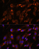 Immunofluorescence analysis of C6 cells using FARSB Polyclonal Antibody at dilution of  1:100. Blue: DAPI for nuclear staining.