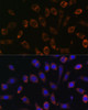 Immunofluorescence analysis of L929 cells using TCIRG1 Polyclonal Antibody at dilution of  1:100 (40x lens). Blue: DAPI for nuclear staining.