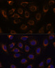 Immunofluorescence analysis of U-2 OS cells using TCIRG1 Polyclonal Antibody at dilution of  1:100 (40x lens). Blue: DAPI for nuclear staining.