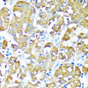 Immunohistochemistry of paraffin-embedded Human stomach using TNFR1 Polyclonal Antibody at dilution of  1:100 (40x lens).