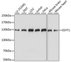 Western blot analysis of extracts of various cell lines using ESYT1 Polyclonal Antibody at dilution of 1:1000.