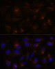 Immunofluorescence analysis of U-2 OS cells using ESYT1 Polyclonal Antibody at dilution of  1:100. Blue: DAPI for nuclear staining.