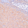 Immunohistochemistry of paraffin-embedded Rat ovary using KANK2 Polyclonal Antibody at dilution of  1:100 (40x lens).