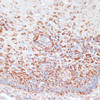 Immunohistochemistry of paraffin-embedded Human esophageal using MRPL46 Polyclonal Antibody at dilution of  1:100 (40x lens).