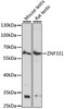 Western blot analysis of extracts of various cell lines using ZNF331 Polyclonal Antibody at dilution of 1:1000.