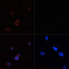 Immunofluorescence analysis of 293T cells using ACACA Polyclonal Antibody at dilution of  1:100. 293T cells were treated by Hydrogen Peroxide (2 nM) at 37℃ for 15 minutes after serum-starvation overnight(left). Blue: DAPI for nuclear staining.