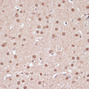 Immunohistochemistry of paraffin-embedded Rat brain using ITCH Polyclonal Antibody at dilution of  1:100 (40x lens).