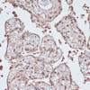 Immunohistochemistry of paraffin-embedded Human placenta using ITCH Polyclonal Antibody at dilution of  1:100 (40x lens).